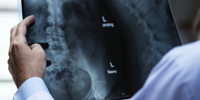 The Value of a Good Medical Checkup