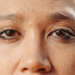 What You Can Do to Lessen the Look of Crow’s Feet
