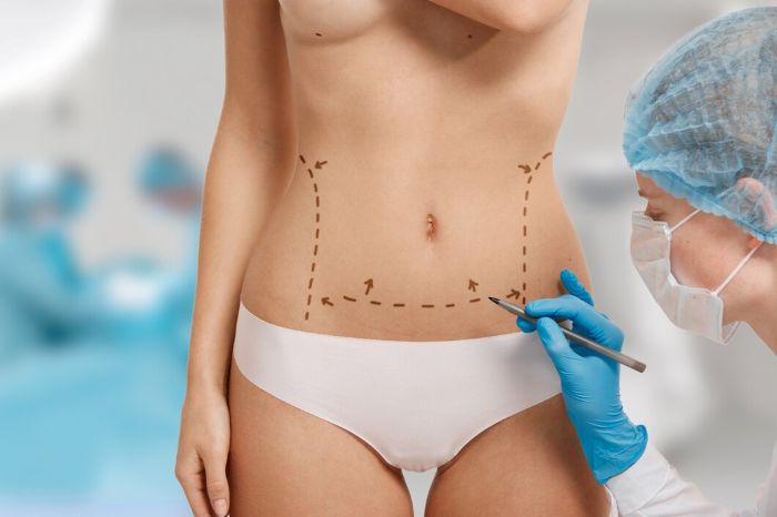 Bariatric surgery