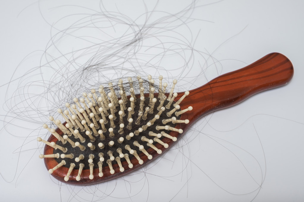 hair loss women