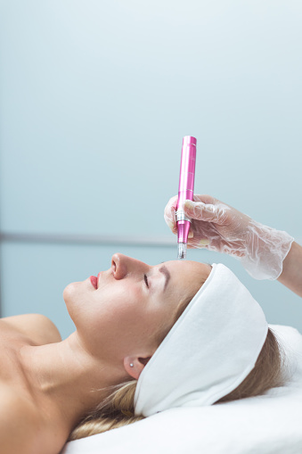 Microneedling