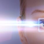 Everything You Need to Know About SMILE Eye Surgery