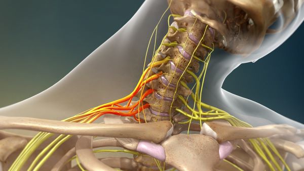 brachial plexus injury