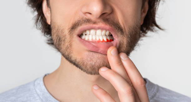 dental injury 