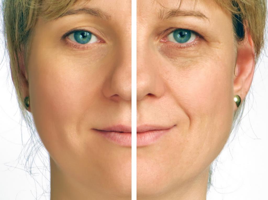 Common Facial Cosmetic Changes: Exploring Popular Procedures