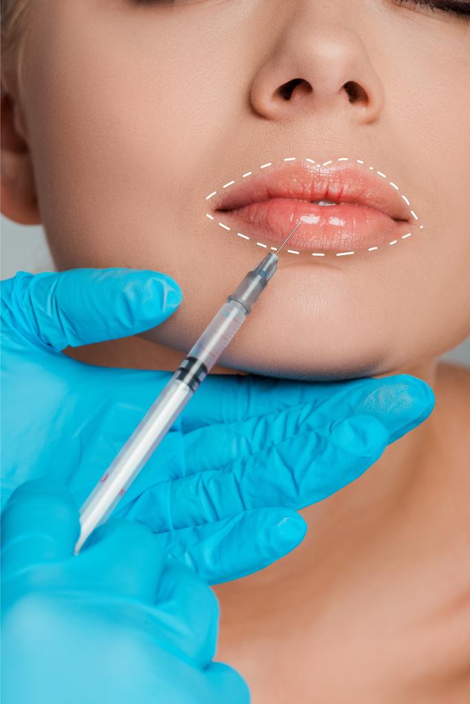 Lip Augmentation