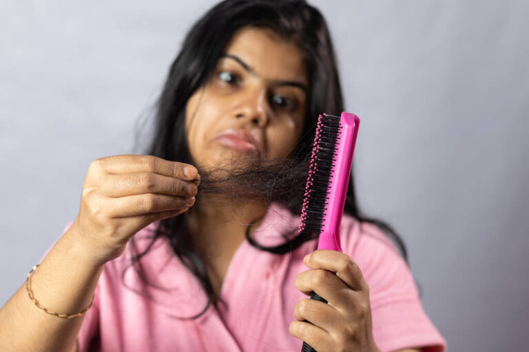 hair loss