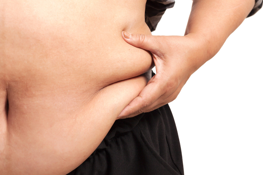 Liposuction