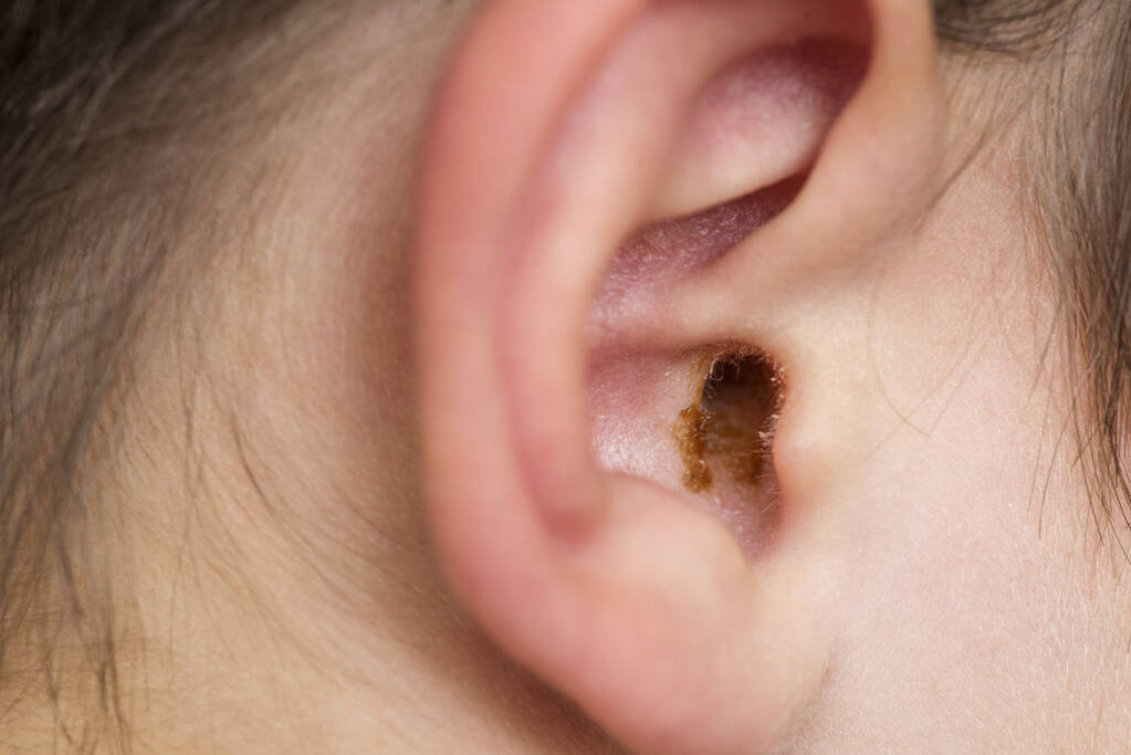Ear Cleaning Doctor