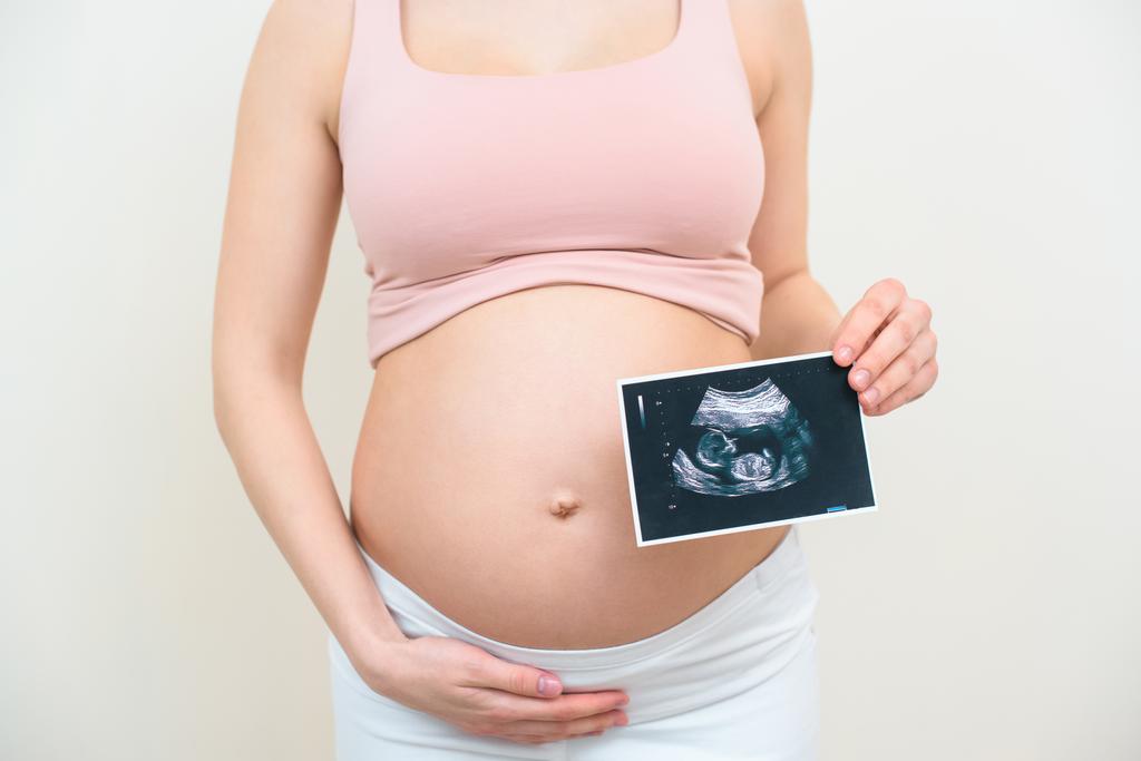 pregnant woman