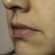 Sensitive Skin: How to Treat It