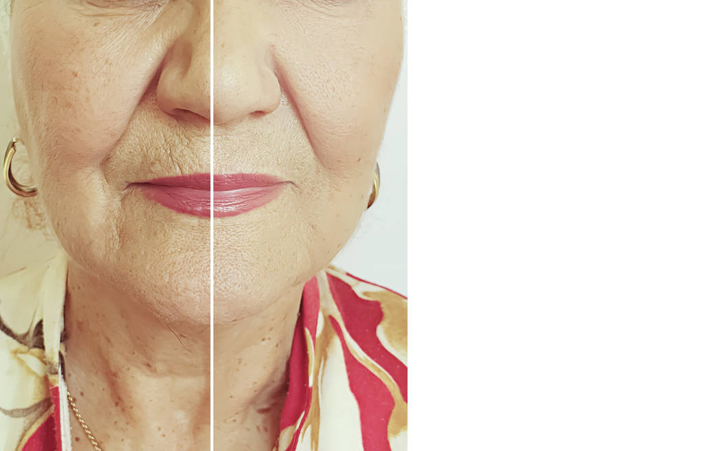 underlying causes of aging