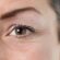 How to differentiate between dehydration lines and wrinkles?
