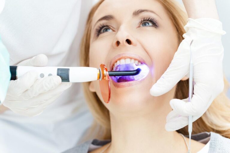 dental curing