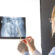 Orthopedic treatments: Restoring Joint Mobility
