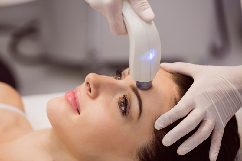  Laser skin resurfacing