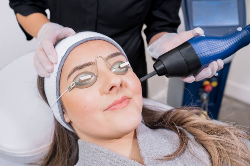  Laser skin resurfacing