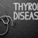 Revealing why Thyroid Problems are more common in Women