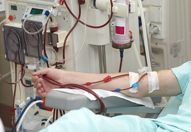  dialysis kidneys