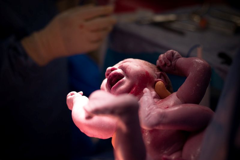 Birth Injury