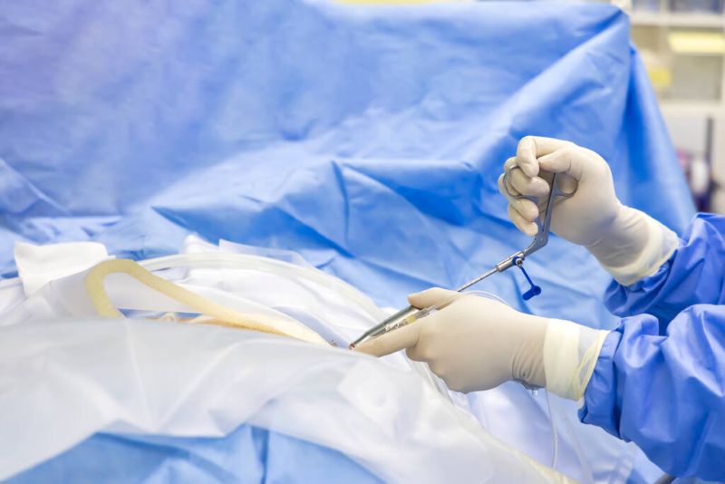 endoscopic spine surgery,