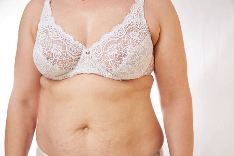 Why Do Breasts Sag