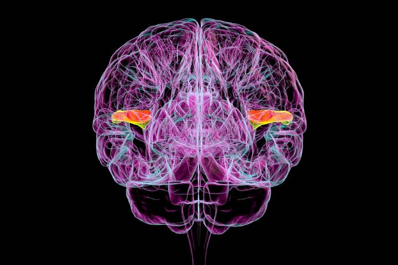 Auditory Processing Disorder 