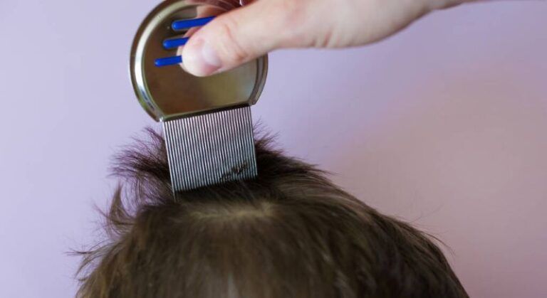 Prevent & treat lice effectively with our comprehensive guide. Learn proven strategies, identify signs, and stop infestations for good.