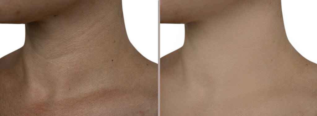 How Do Cosmetic Procedures Impact Self-Esteem?