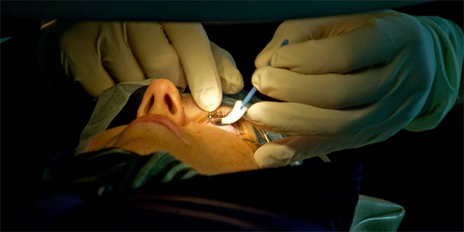 Want Better Vision? LASIK Is the Answer