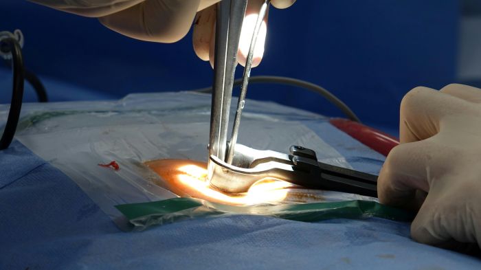 Spine Surgery for Seniors: What You Need to Know