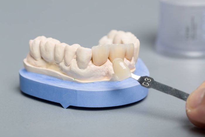 How Restorative Dentistry Impacts Daily Life