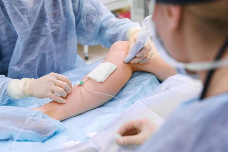 Recovery Tips After Vein Treatment Procedures
