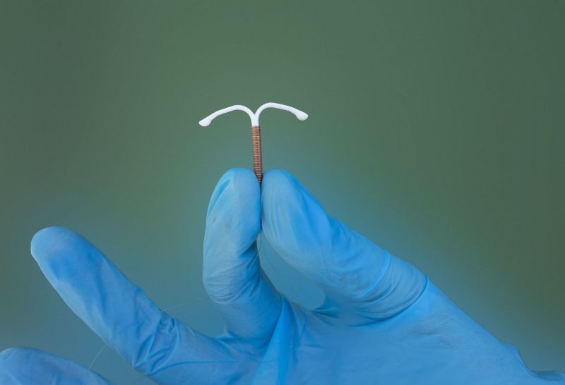 Copper IUDs Copper IUDs