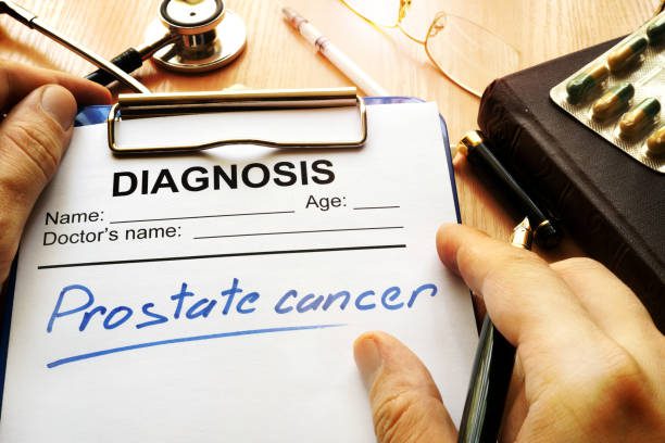 Prostate Cancer Diagnosis