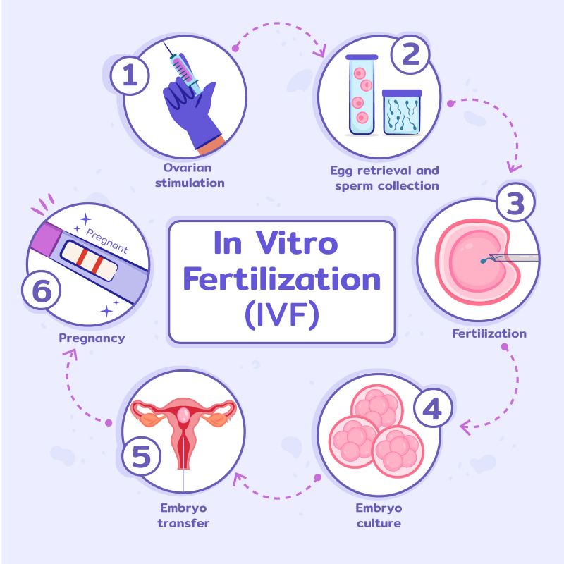 In Vitro Fertilization
