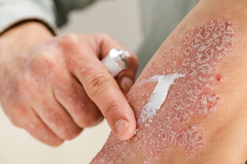 Is It Time for You to Seek Professional Skincare Treatment?