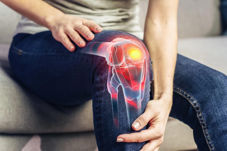 Knee Osteoarthritis