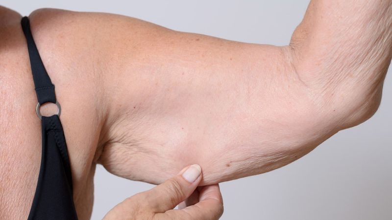 Sarcopenia Prevention: How to Protect Muscle and Strength as You Age Sarcopenia Prevention: How to Protect Muscle and Strength as You Age