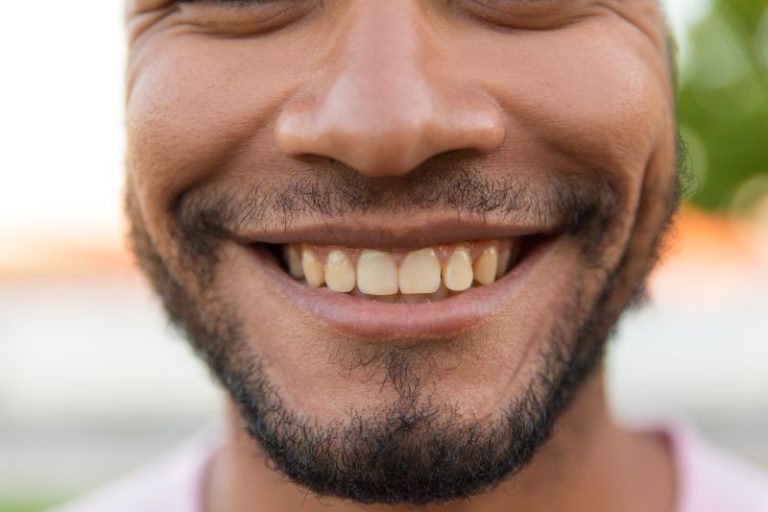 How to Remove Plaque from Teeth: The Complete Guide