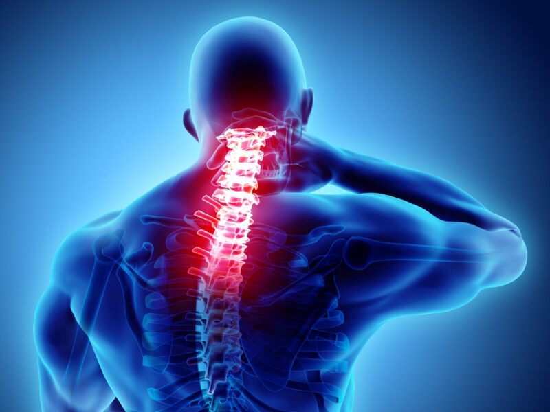 spinal arthritis spinal arthritis