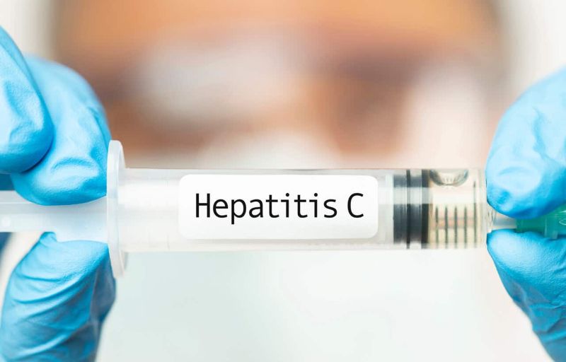 hepatitis C
