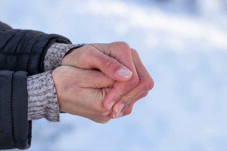 How to Prevent Dry Hands During the Cold Months
